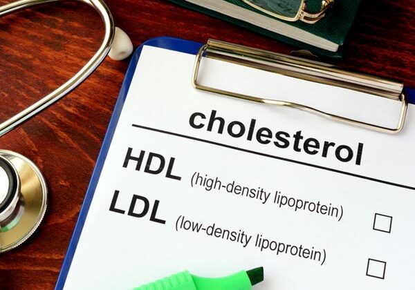 cholesterol-687013434